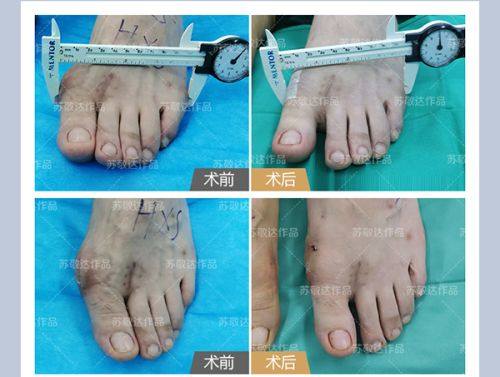 万鹏医生口碑评价