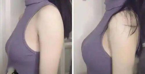 佛山她尚医疗美容门诊部擅长项目：