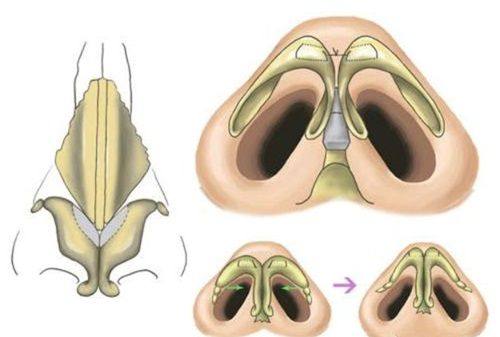 西安洛颜记医疗美容医院擅长项目：