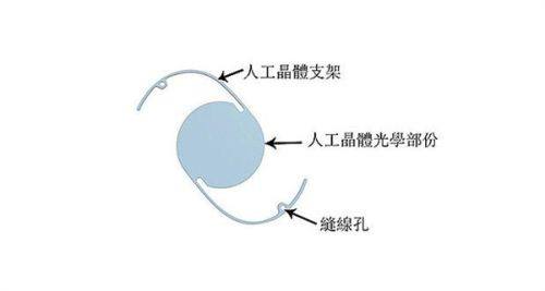 五、家长该如何应对孩子生病时的“双眼皮变化”
