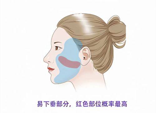 四、做完眼袋手术后的通用护理要点