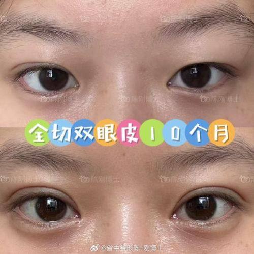 沈阳斯美诺医疗美容门诊价格表(使用标签):