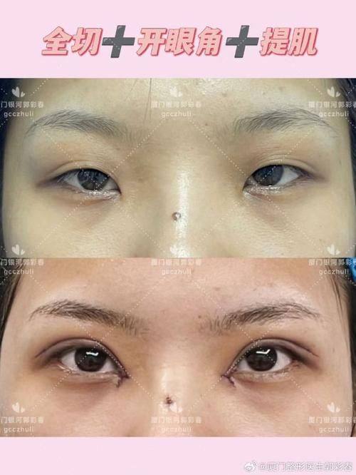 石家庄星源美天医疗美容医院地址电话及营业时间：