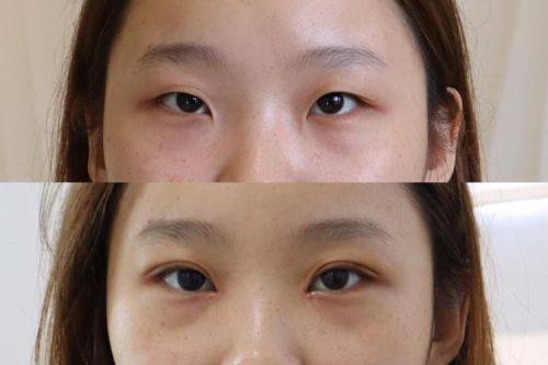 王丽琴医生怎么预约