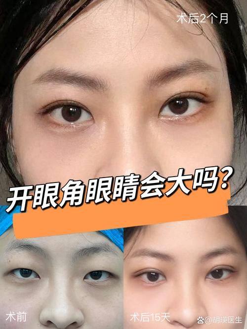 杭州醉美桃花源医疗美容诊所价格表：