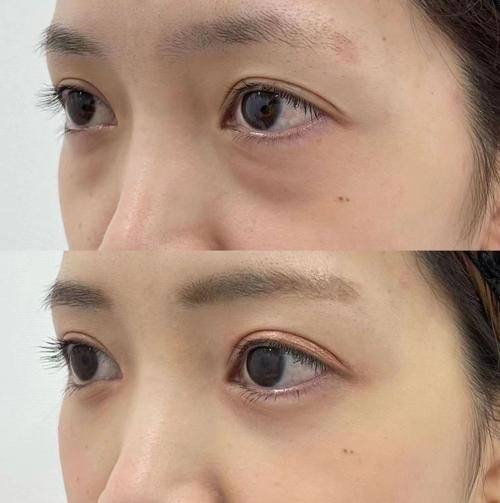 佛山她尚医疗美容门诊部怎么样？