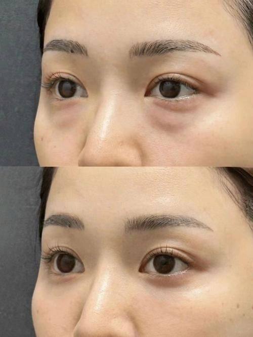 佛山她尚医疗美容门诊部价格表：