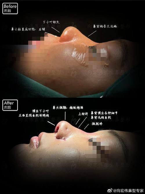 宁波市海曙美之术医疗美容诊所医生名单及擅长领域：