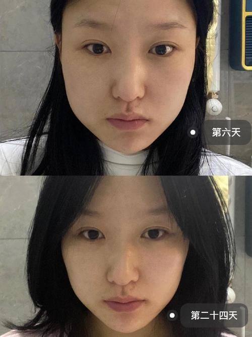 吴边医生技术优势