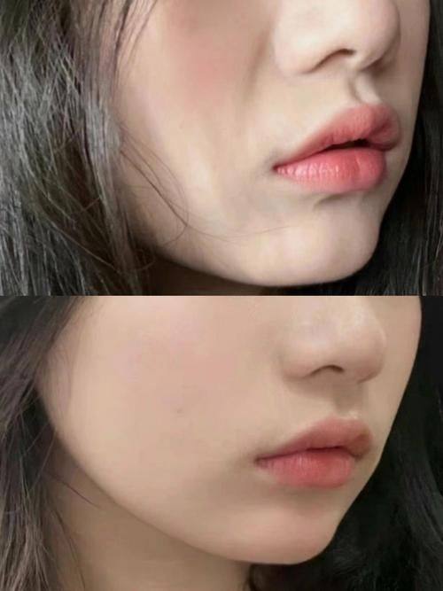 吴边医生怎么预约