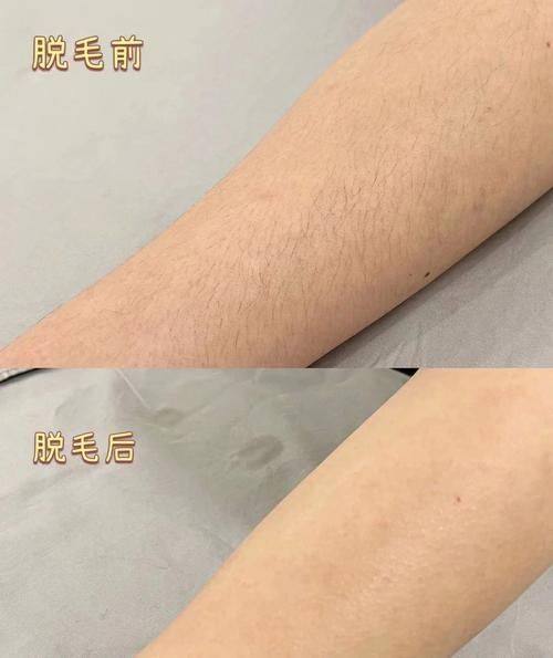 深圳福华中医和西医结合医院皮肤美容科口碑评价：