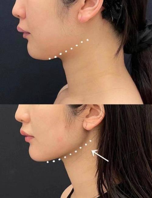 李廷友医生技术优势