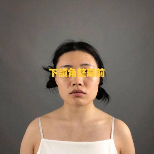 石家庄星源美天医疗美容医院口碑评价：