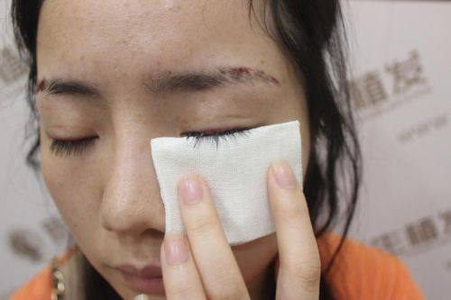 车墩发医生技术优势