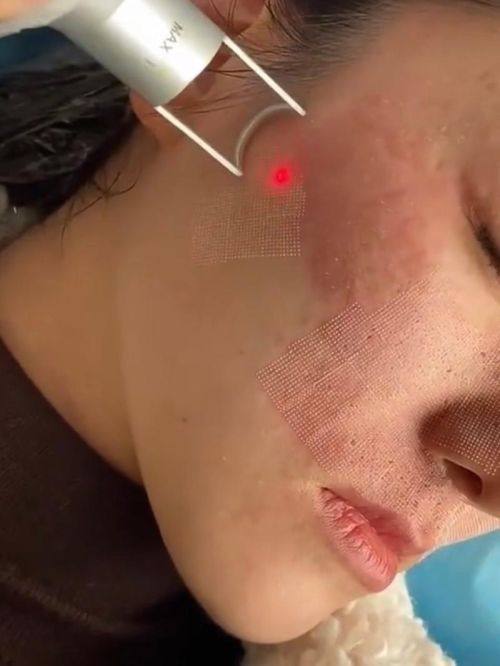 武汉新菲妍整形医院擅长项目：