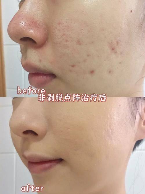 武汉新菲妍整形医院地址电话及营业时间：