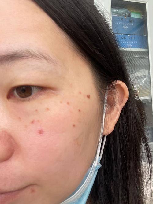 固始易韩医疗美容诊所价格表