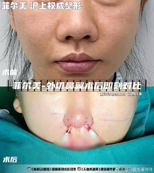 李明钟医生擅长领域