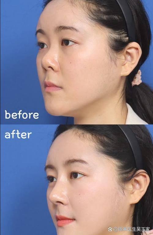 沈阳斯美诺医疗美容门诊怎么样?