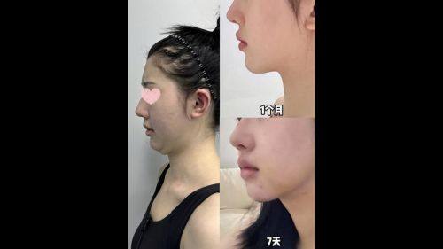 固始易韩医疗美容诊所口碑评价