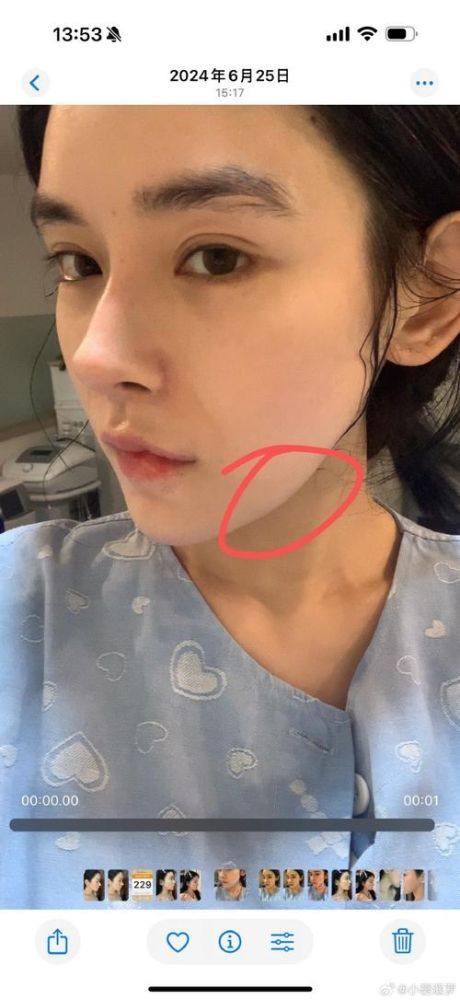 李廷友医生擅长领域