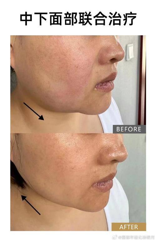 昆明辛德瑞拉医疗整形美容预约挂号方式：