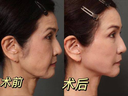 昆明辛德瑞拉医疗整形美容地址电话及营业时间：