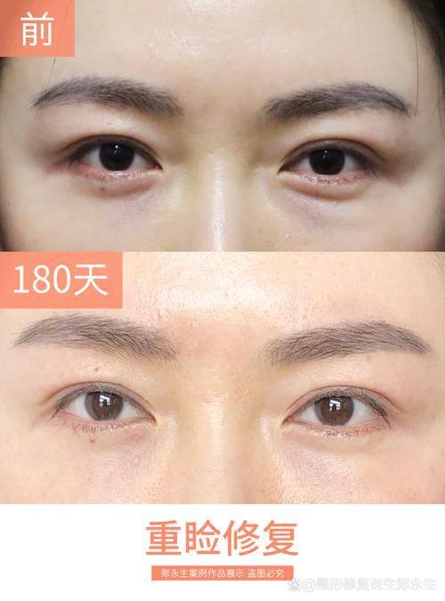 白玲医生怎么预约