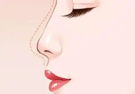 三、未成年眼袋怎么消除更有效:长期护理方案