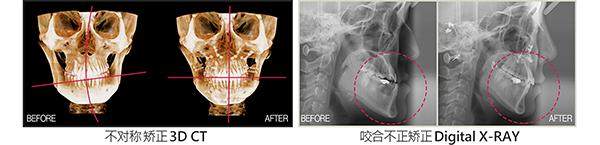 韩国Faceline整形外科医院医生名单及擅长领域：