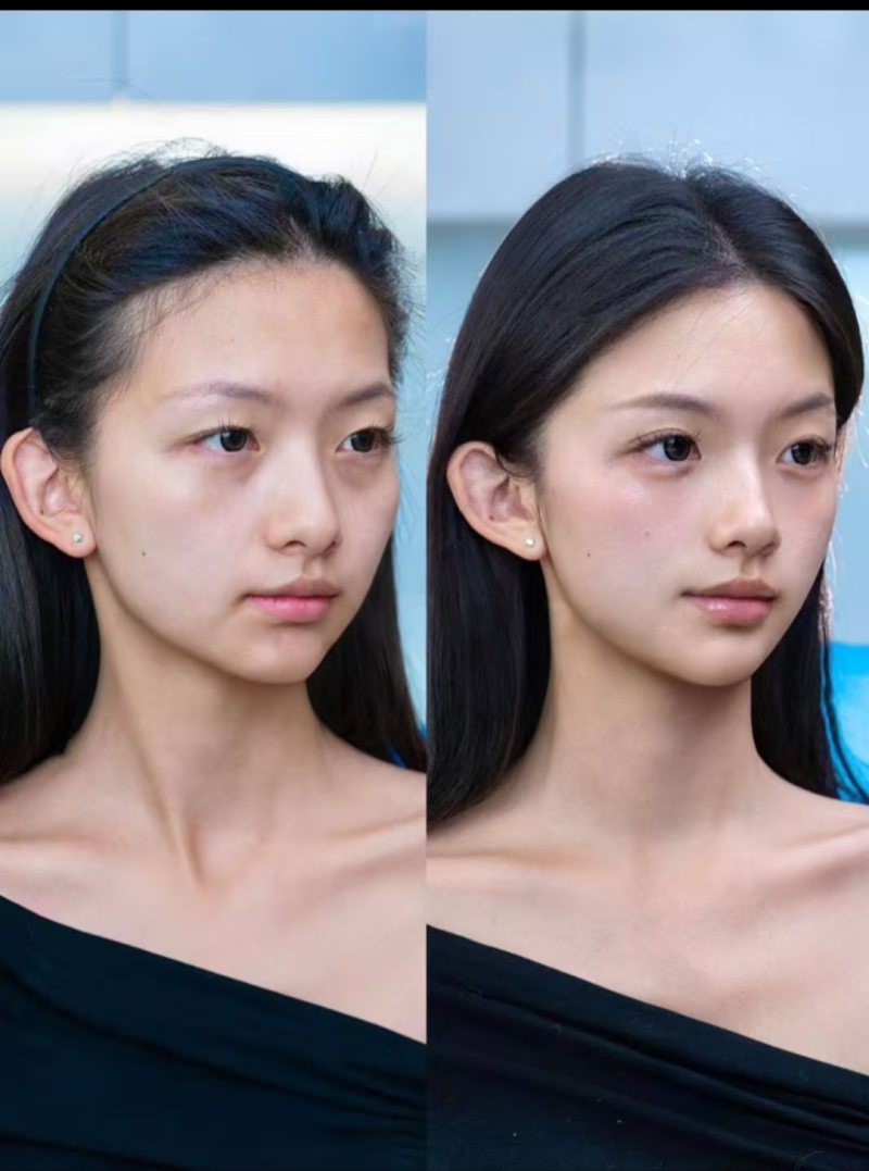 二、手术操作相关的直接损伤风险