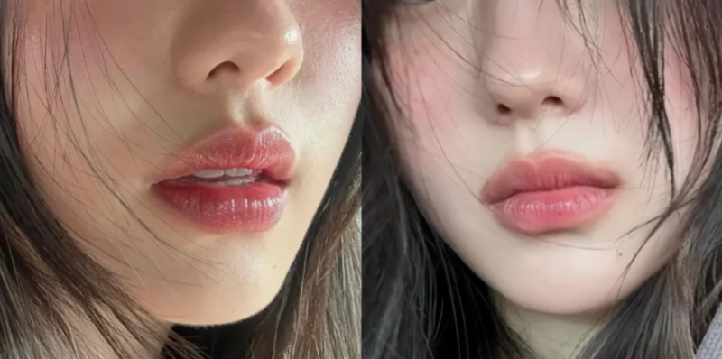 西安洛颜记医疗美容医院价格表：