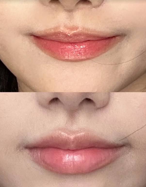 郑州花锦医疗美容门诊部价格表：