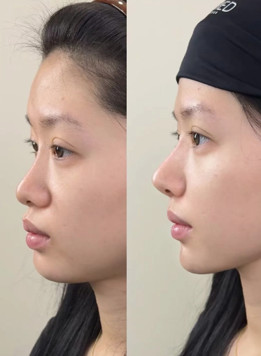 太原每天美整形医院预约挂号方式：