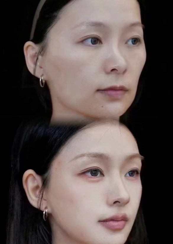 宁波市海曙美之术医疗美容诊所擅长项目：