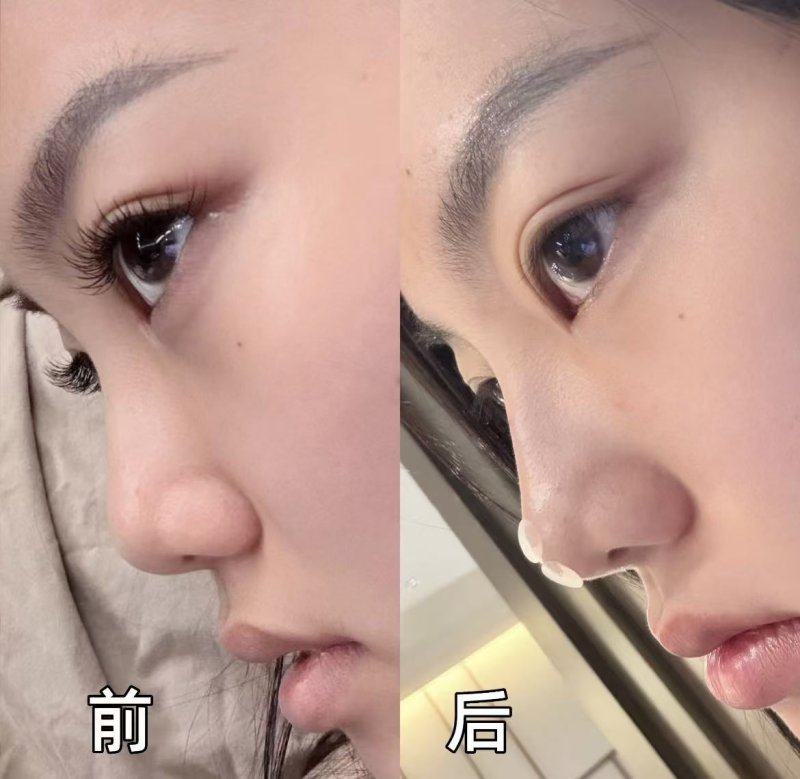 董鹤亮医生擅长领域