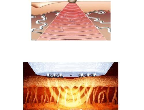刘佺医生口碑评价