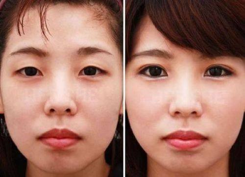 三亚悦已婕熹卡医疗美容外科门诊部地址电话及营业时间: