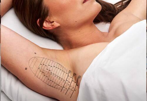 二、5种适配疤痕子宫的修补方法详解