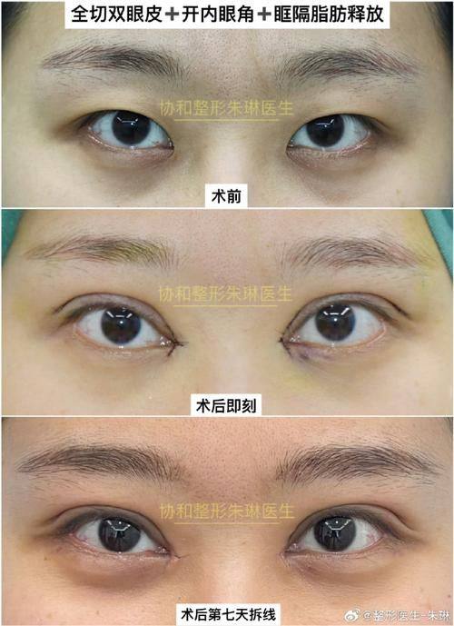 北京佳妍整形医疗美容诊所口碑评价: