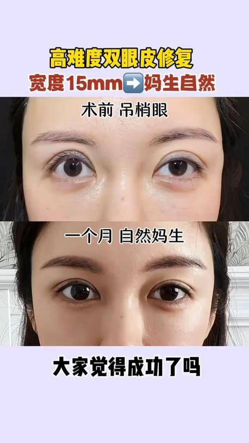 郑州喜美医疗美容门诊部怎么样？