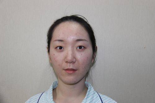 杭州加颜医疗美容擅长项目：