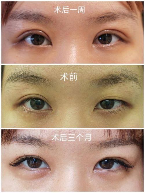 郑州喜美医疗美容门诊部医生名单及擅长领域：