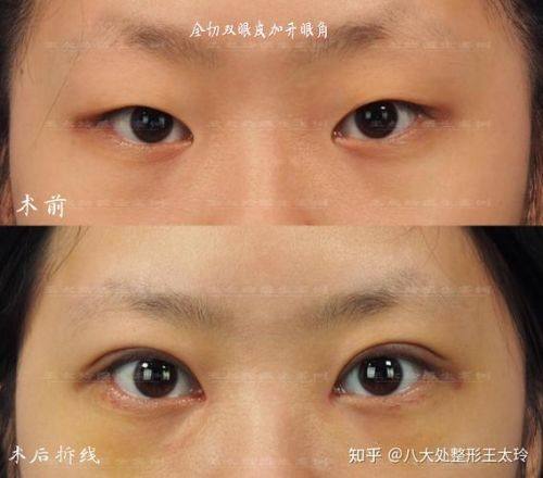 曲靖市麒麟区吴氏嘉美医疗美容门诊部价格表