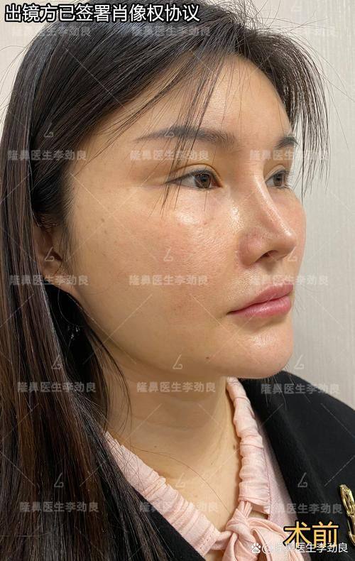 北京佳妍整形医疗美容诊所价格表: