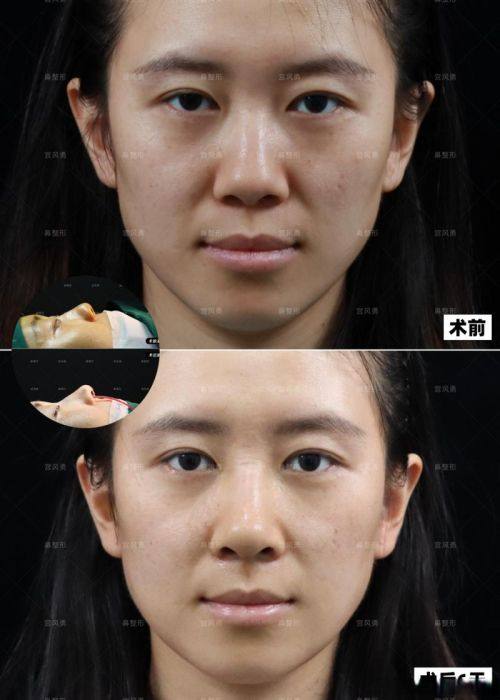 千叶中央美容形成擅长项目：