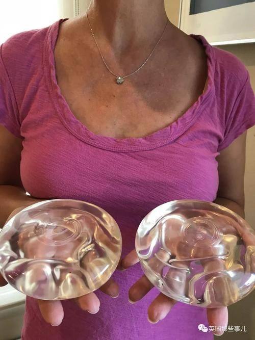 台湾全美整形診所口碑评价