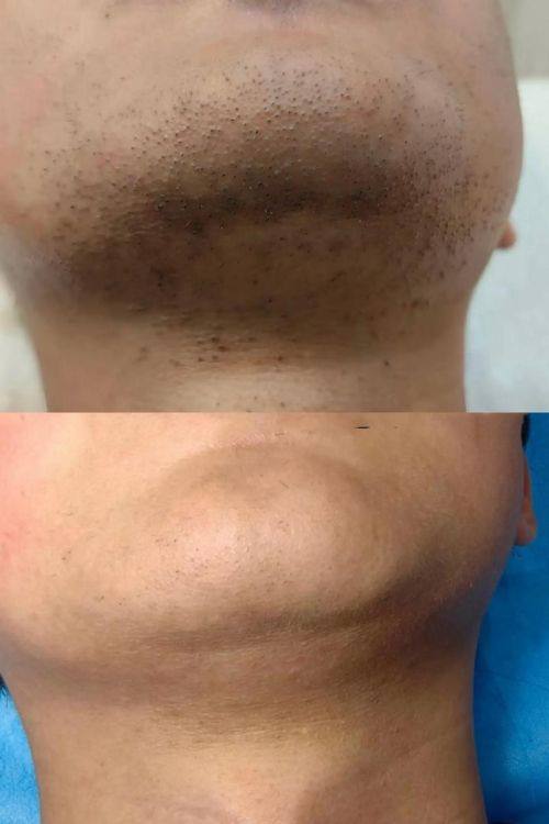 锦州福际植发口碑评价: