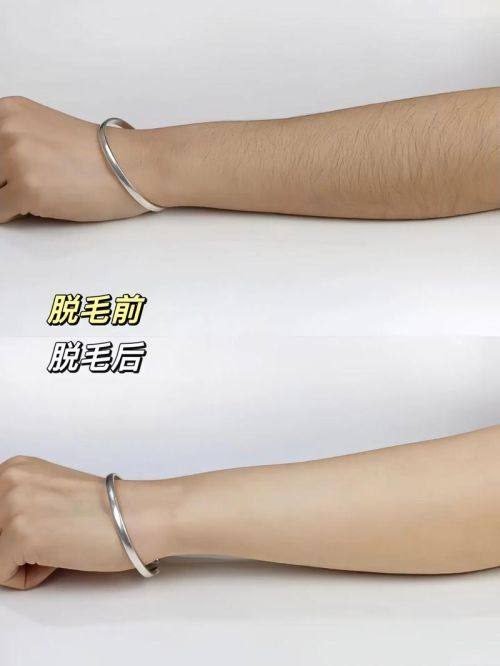 上饶市沃美医疗美容医院预约挂号方式