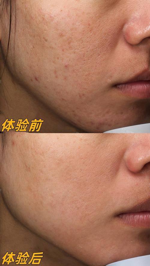 岳阳乔微雅整形医院价格表